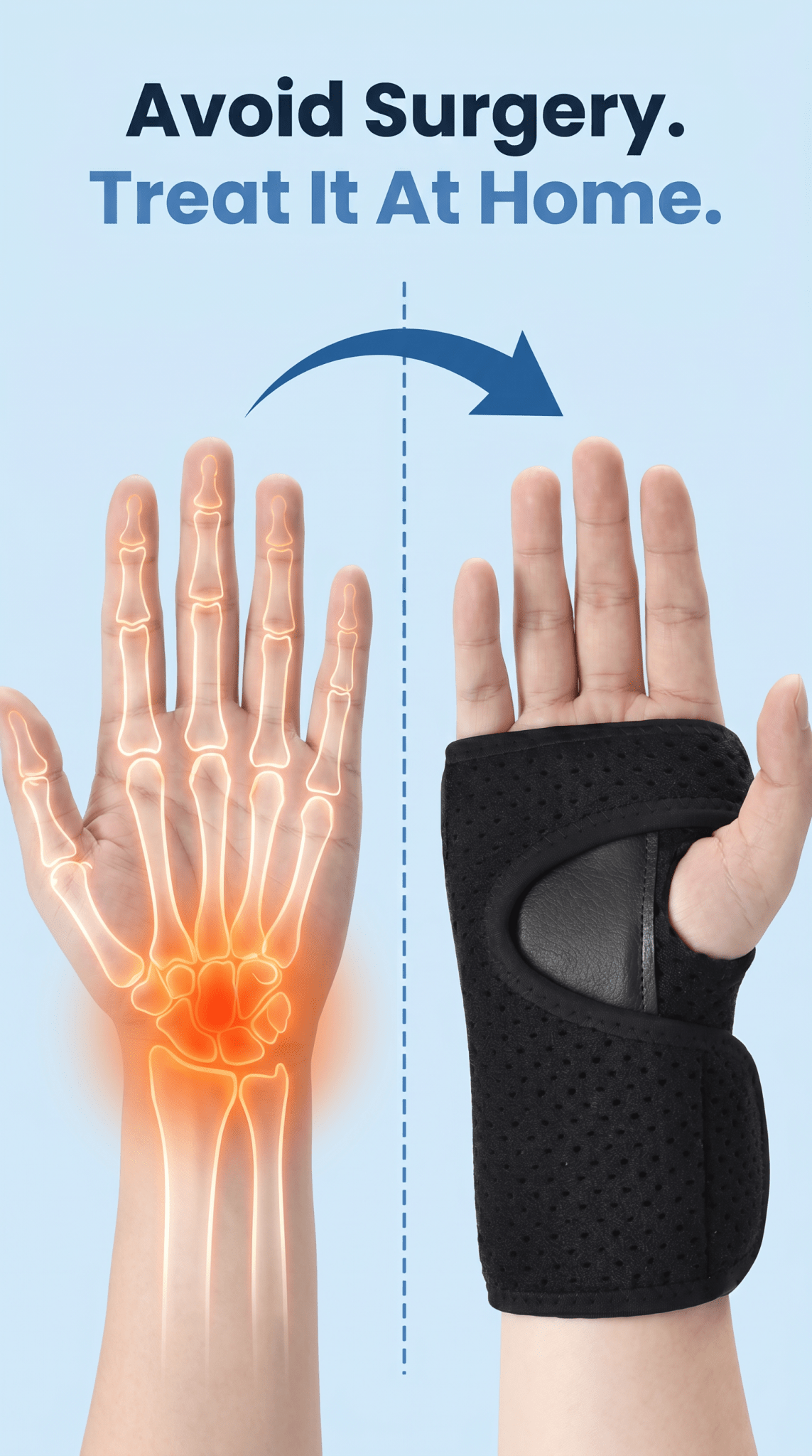 Sleepwrist Carpal Tunnel Brace - avoid surgery with at-home wrist support
